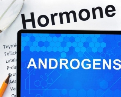 Androgen Là Gì? Tác Động Của Androgen Đến Mái Tóc